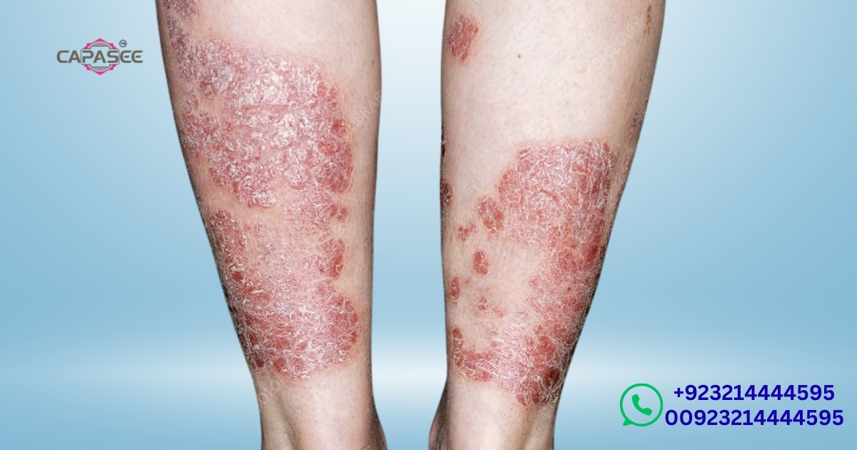 phototherapy-light-treatments-for-every-need-eczema-pruritus-pigmentation-and-more