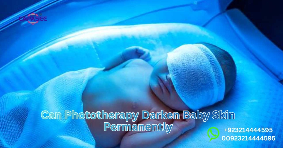 Phototherapy Darken Baby Skin