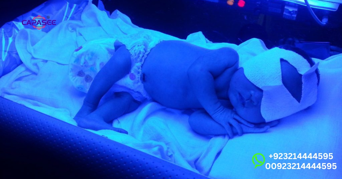 Effective Jaundice Treatment at Home: Choosing the Best Light Therapy for Quick Recovery