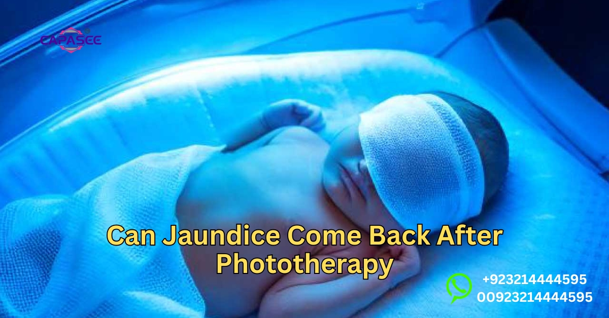 Jaundice Come Back After Phototherapy