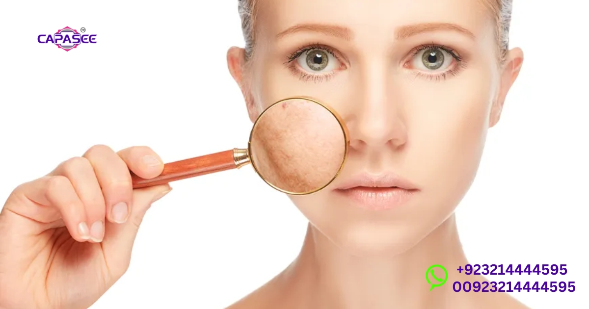 Phototherapy and Baby Skin: Key Side Effects, Pigmentation Changes, and Recovery Tips