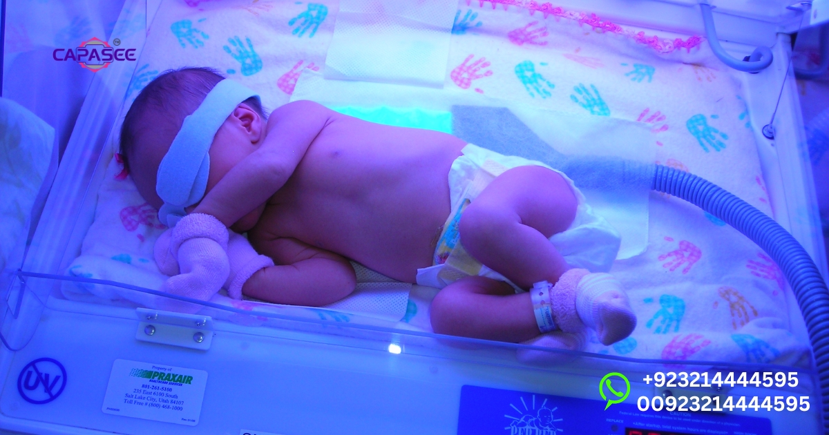 Why Does Jaundice Come Back After Phototherapy? Neonatal Jaundice Rebound