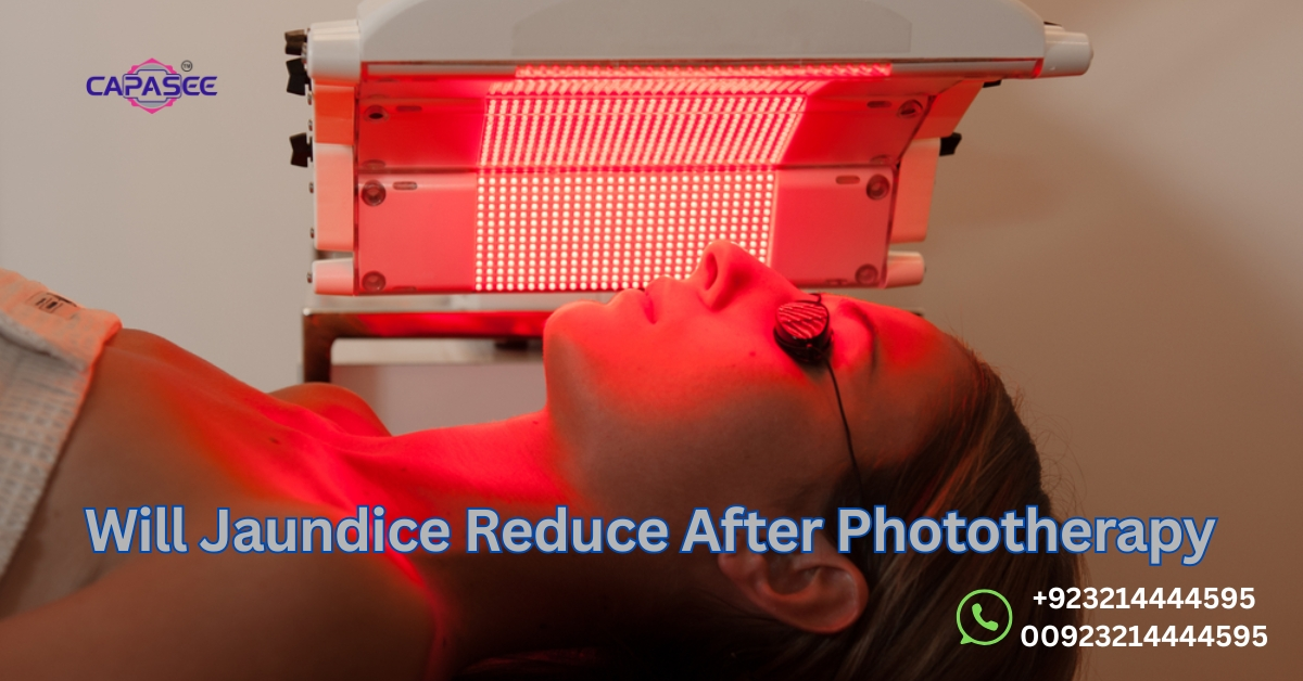 Jaundice Reduce After Phototherapy