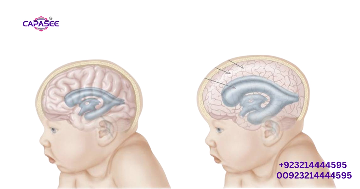 Bilirubin Levels & Risk Factors