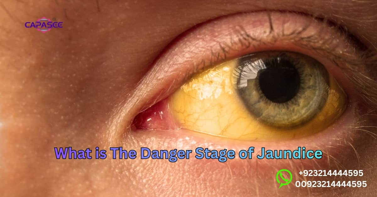 Danger Stage of Jaundice