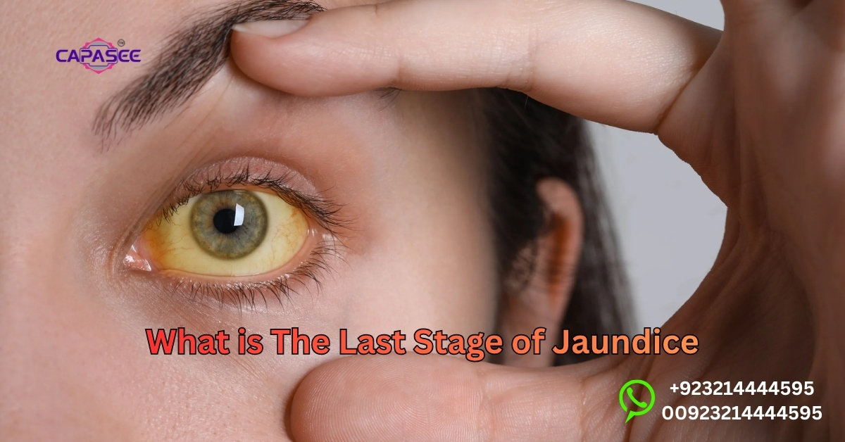 Last Stage of Jaundice