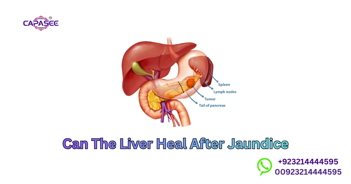Liver Heal After Jaundice