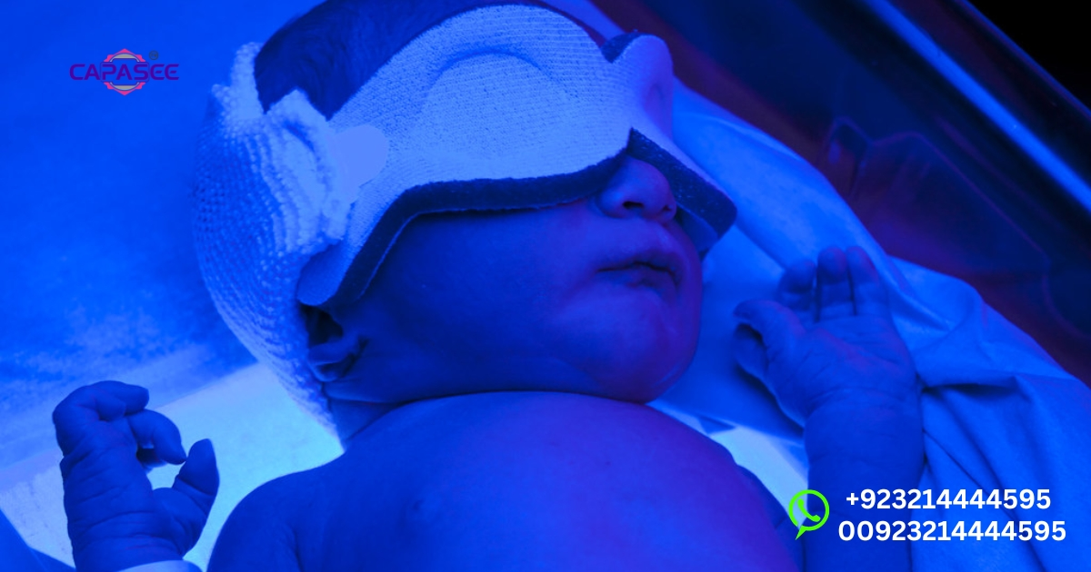 Signs Baby Needs Phototherapy