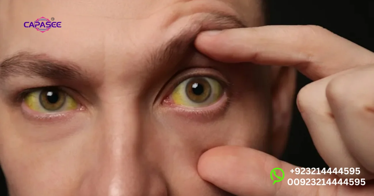 Top Jaundice Tablets