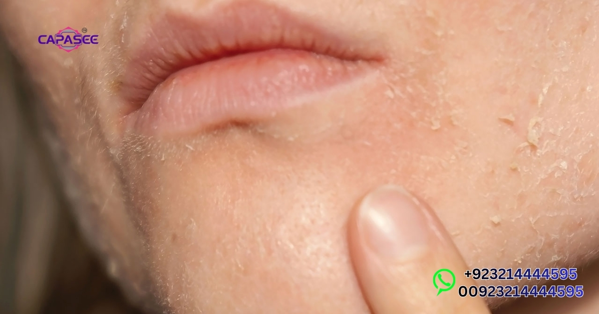 Skin & Dehydration Issues