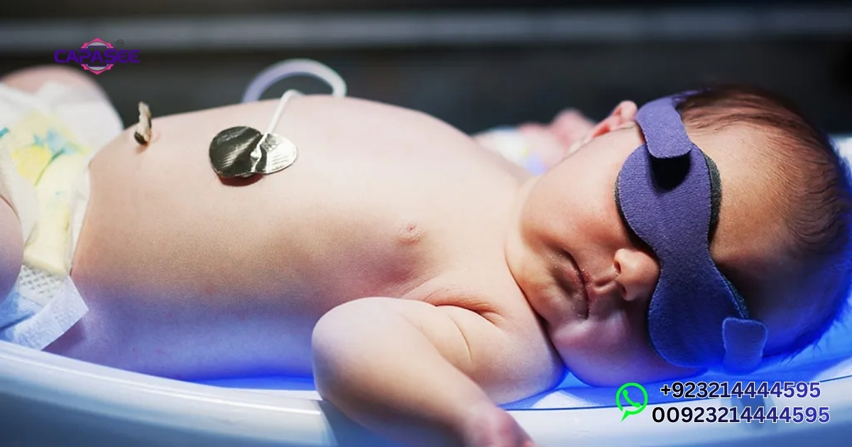 Top Benefits of Baby Phototherapy Treatment