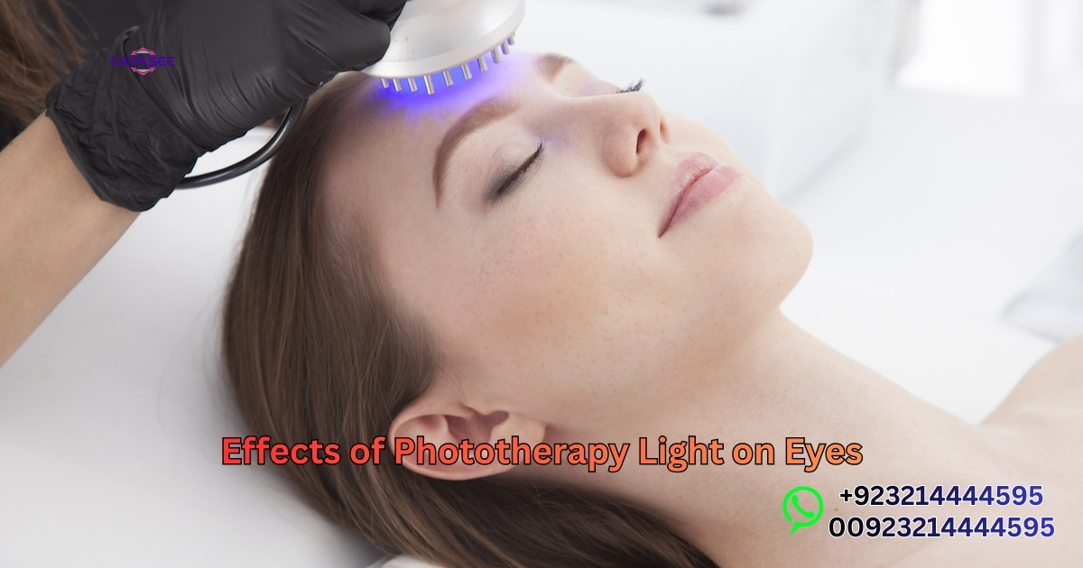 Effects of Phototherapy Light on Eyes