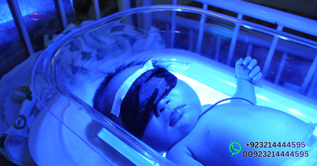 Home Phototherapy Jaundice With Capasee