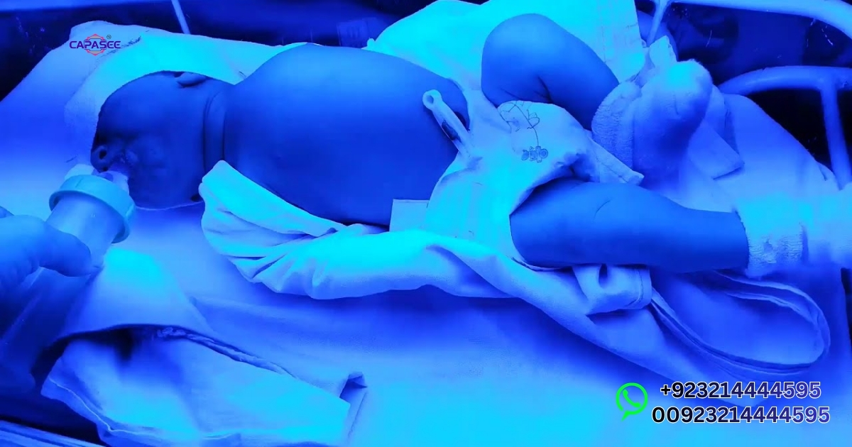 How Blue Light Reduces Bilirubin