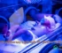 Is Phototherapy Light Safe for Newborns Eyes