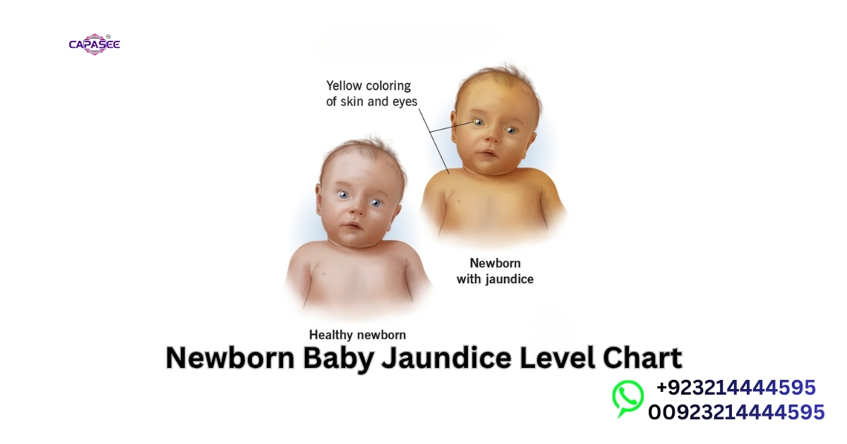 Newborn Baby Jaundice Level Chart