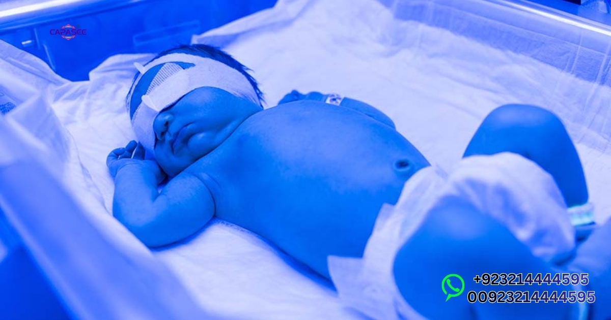 Phototherapy Chart for Newborns Pakistan