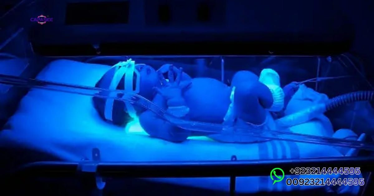 Phototherapy Light for Jaundice in Pakistan