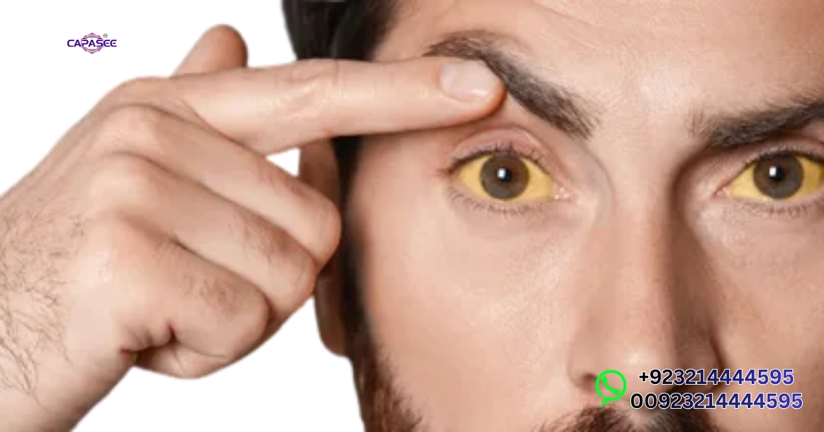 Buying Guide and Care Tips for Home Jaundice Treatment