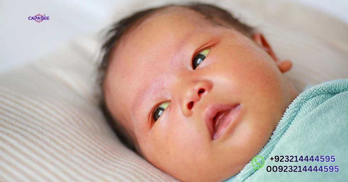 Safe Home Based Treatments for Neonatal Jaundice in Pakistan