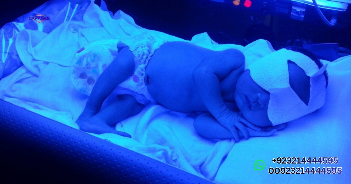 Best Phototherapy Light Price in Pakistan – 2026 Cost Comparison