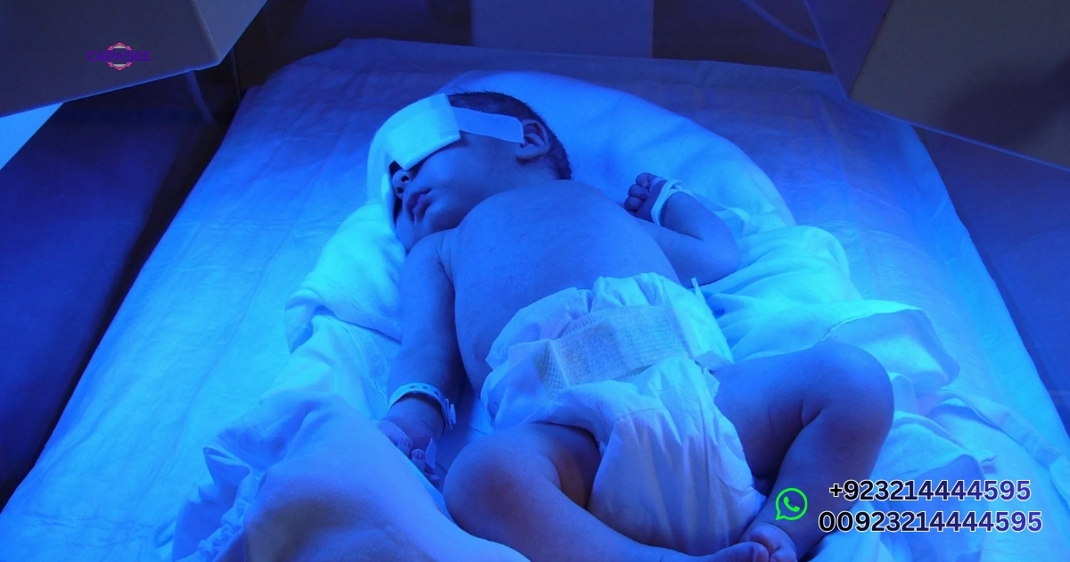 What Is Phototherapy Treatment for Newborn Jaundice?